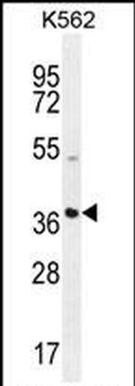 SFRP4 Antibody in Western Blot (WB)