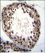 TTC23L Polyclonal Antibody