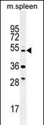 TTC23L Antibody in Western Blot (WB)