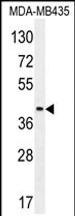 LILRA5 Antibody in Western Blot (WB)