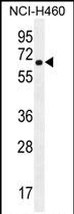 CHRND Antibody in Western Blot (WB)