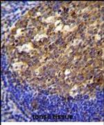 TWF2 Antibody in Immunohistochemistry (IHC)