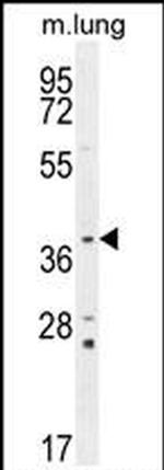 TWF2 Antibody in Western Blot (WB)