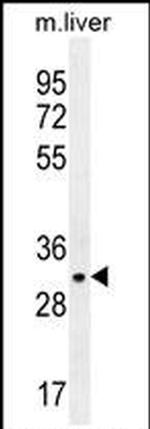 JAZF1 Antibody in Western Blot (WB)