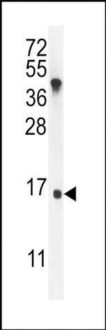 IGKV2-29 Antibody in Western Blot (WB)