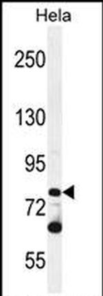 PCDHB10 Antibody in Western Blot (WB)