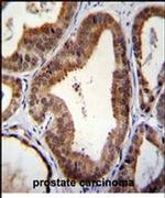 SHQ1 Antibody in Immunohistochemistry (IHC)