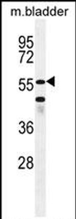 SHQ1 Antibody in Western Blot (WB)