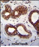 KIAA1586 Antibody in Immunohistochemistry (IHC)