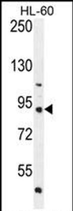 KIAA1586 Antibody in Western Blot (WB)