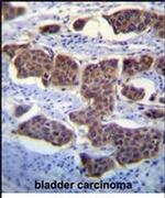 PALM3 Antibody in Immunohistochemistry (IHC)