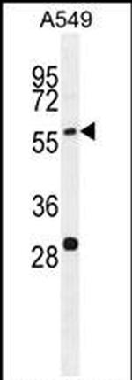 PALM3 Antibody in Western Blot (WB)