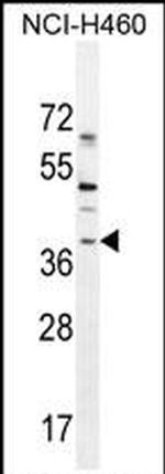 SOX1 Antibody in Western Blot (WB)