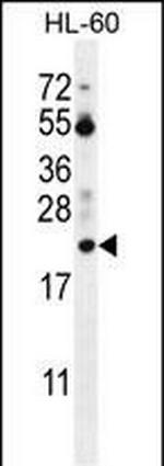 PTMA Antibody in Western Blot (WB)