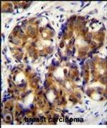 RHAMM Antibody in Immunohistochemistry (IHC)