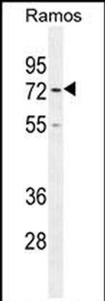 RHAMM Antibody in Western Blot (WB)