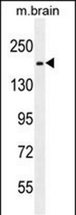 FIP200 Polyclonal Antibody