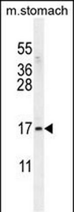 ZNF428 Polyclonal Antibody