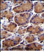 LRWD1 Antibody in Immunohistochemistry (IHC)