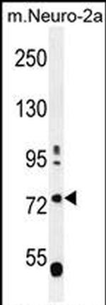 LRWD1 Antibody in Western Blot (WB)