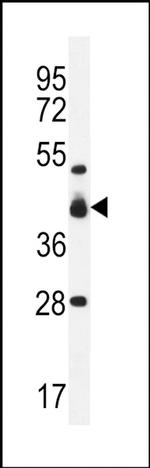VSIG8 Antibody in Western Blot (WB)