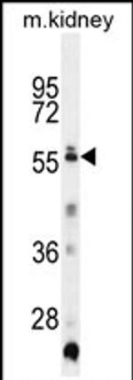Triml1 Antibody in Western Blot (WB)
