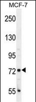 CTAGE4 Polyclonal Antibody