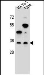 GPM6B Antibody in Western Blot (WB)