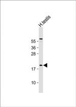 CT45A Polyclonal Antibody