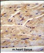 FAM82B Antibody in Immunohistochemistry (IHC)