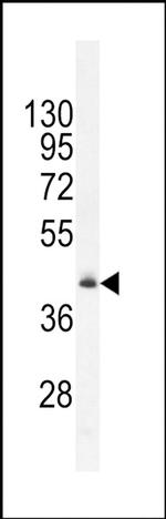 FAM82B Antibody in Western Blot (WB)