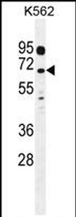 LRRC63 Antibody in Western Blot (WB)