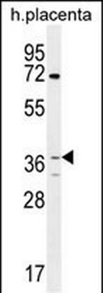 OR2AT4 Antibody in Western Blot (WB)