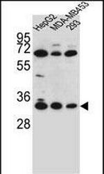OR2T3 Antibody in Western Blot (WB)
