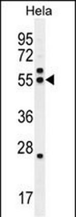 TUBB8P12 Polyclonal Antibody