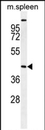 STK32A Antibody in Western Blot (WB)