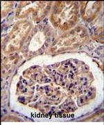 MGP Antibody in Immunohistochemistry (IHC)