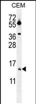 MGP Antibody in Western Blot (WB)