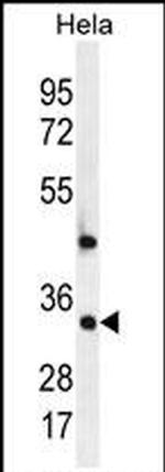CRSP9 Antibody in Western Blot (WB)