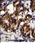 TRADD Antibody in Immunohistochemistry (IHC)