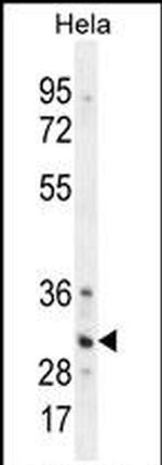 TRADD Antibody in Western Blot (WB)