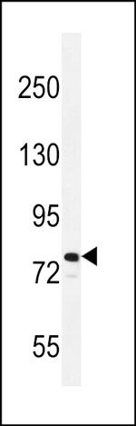 RAD54L Polyclonal Antibody