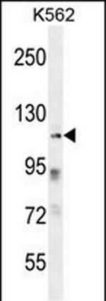 ZNF99 Polyclonal Antibody