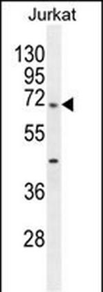 TBC1D3H Polyclonal Antibody
