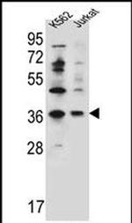 PPP1R3G Antibody in Western Blot (WB)