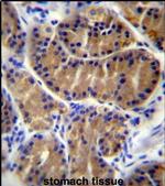IL17B Antibody in Immunohistochemistry (IHC)