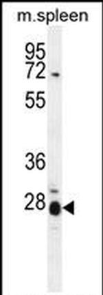 IL17B Antibody in Western Blot (WB)