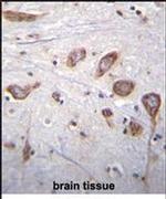 PLCL2 Antibody in Immunohistochemistry (IHC)