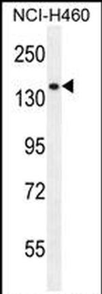 PLCL2 Antibody in Western Blot (WB)