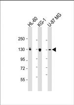 DEPDC5 Polyclonal Antibody